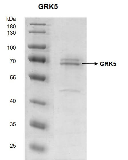 Recombinant GRK5 protein