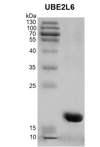 Recombinant UBE2L6 protein analyzed by SDS-PAGE gel.
