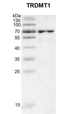 Recombinant TRDMT1 protein