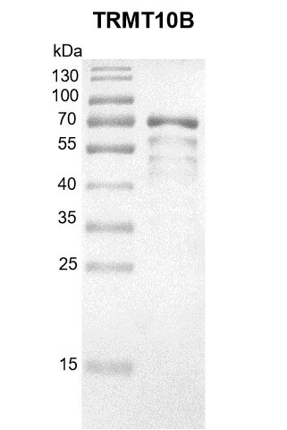 Recombinant TRMT10B protein