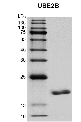 Recombinant UBE2B protein gel.