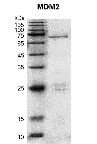 Recombinant MDM2 protein Coomassie gel