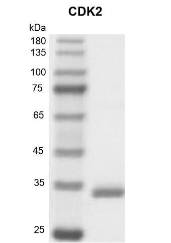 Recombinant CDK2 protein gel