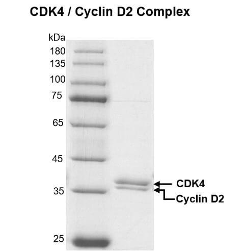 Recombinant CDK4/Cyclin D2 protein gel