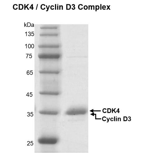 Recombinant CDK4/Cyclin D2 protein gel