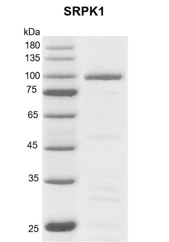 Recombinant SRPK1 protein gel