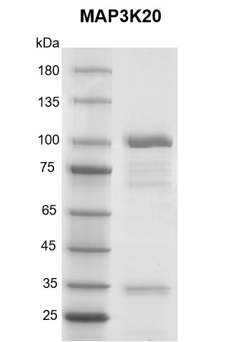 Recombinant MAP3K20 protein gel