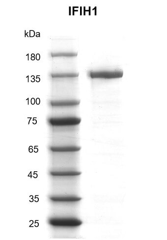 Recombinant IFIH1 protein gel