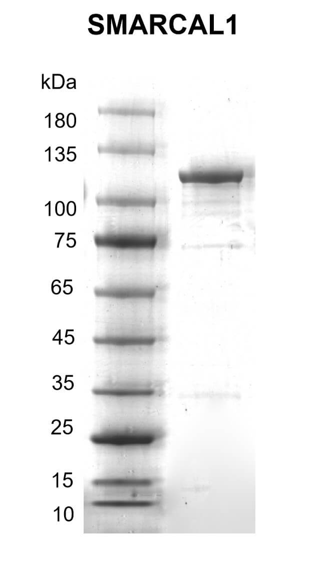 Recombinant SMARCAL1 protein gel