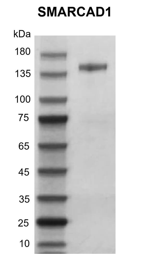 Recombinant SMARCAD1 protein gel
