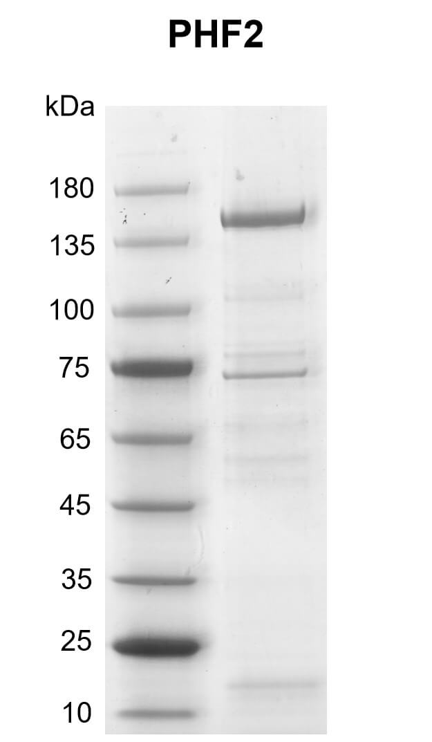 Recombinant PHF2 protein gel
