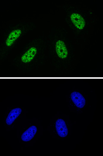 AbFlex<sup>®</sup> RNA Pol II CTD phospho Tyr1 antibody (rAb) tested by immunofluorescence.