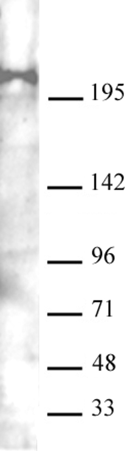 AbFlex<sup>&reg;</sup> Mi-2 beta (CHD4) antibody (rAb) tested by Western blot.