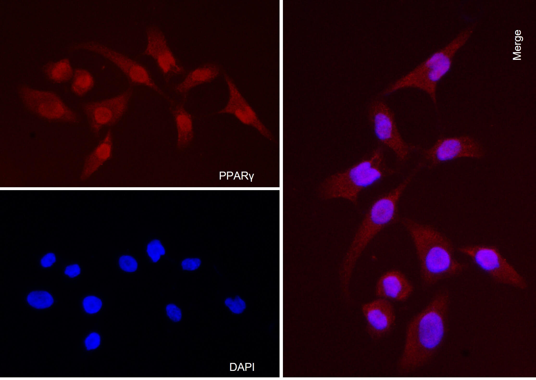 AbFlex<sup>®</sup> PPARγ antibody (rAb) tested by immunofluorescence.
