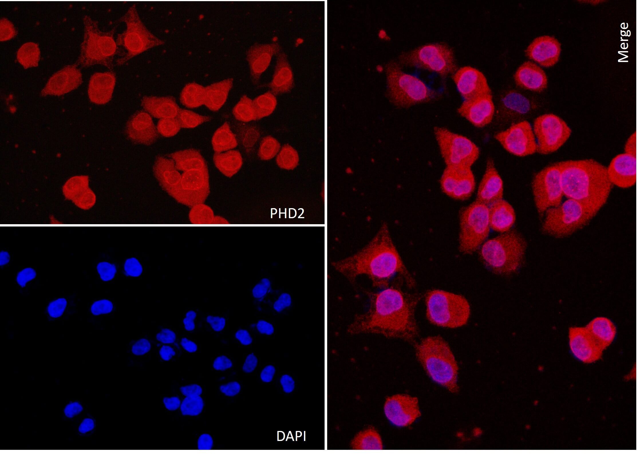 AbFlex<sup>®</sup> PHD2 (EGLN1) antibody (rAb) tested by immunofluorescence.