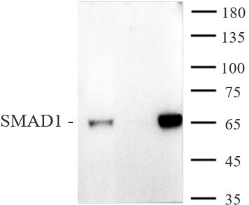 AbFlex<sup>®</sup> SMAD1 antibody (rAb) tested by immunoprecipitation.