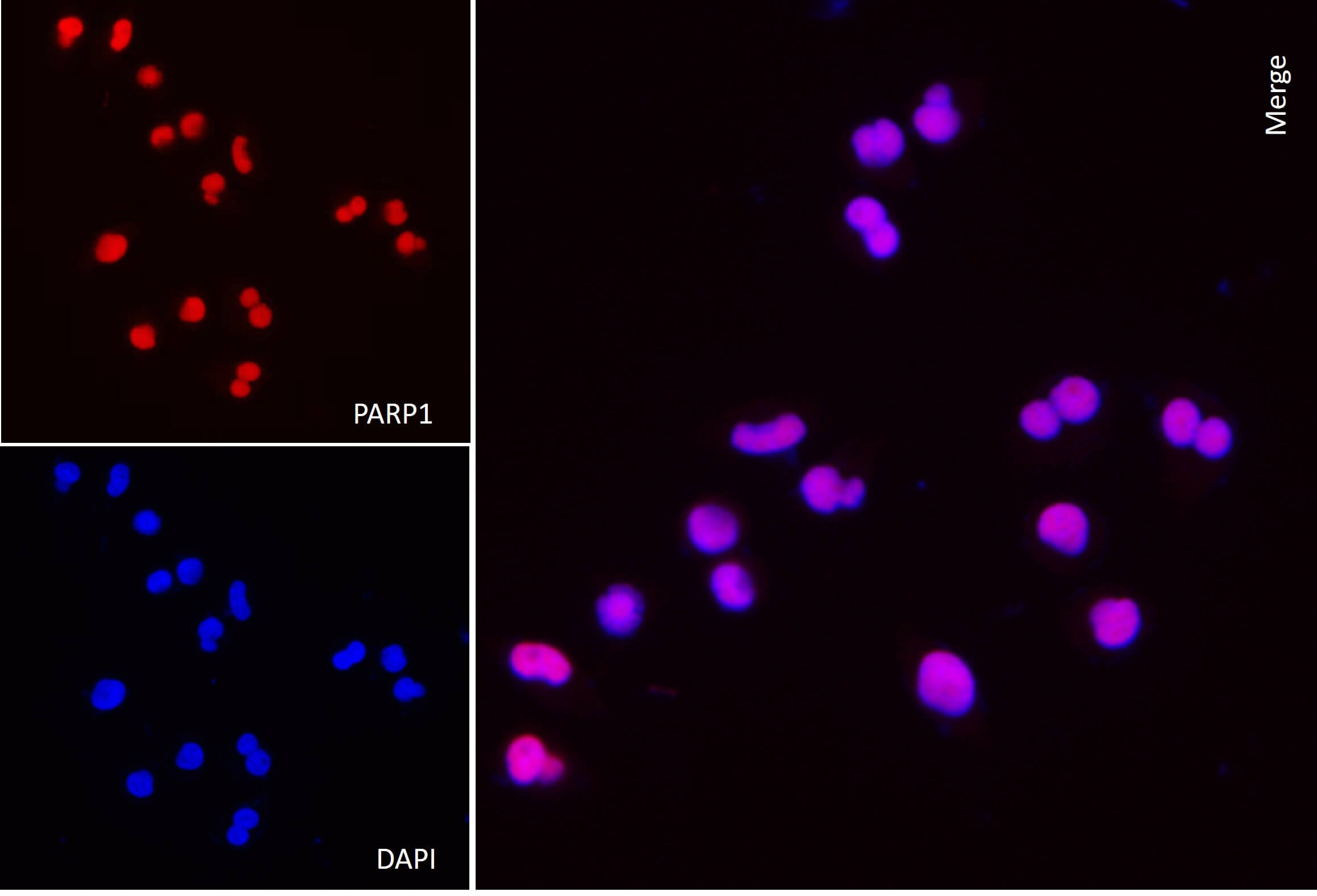 AbFlex<sup>®</sup> PARP1 antibody (rAb) tested by immunofluorescence.