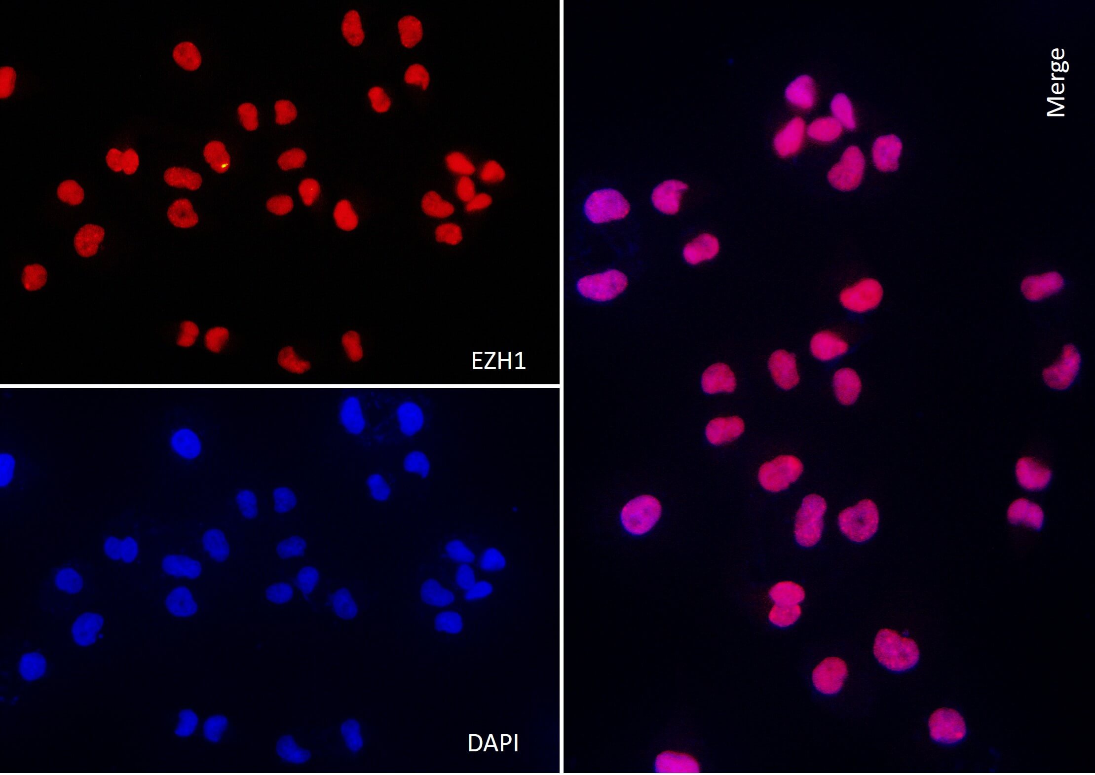 AbFlex<sup>®</sup> EZH1 antibody (rAb) tested by immunofluorescence.