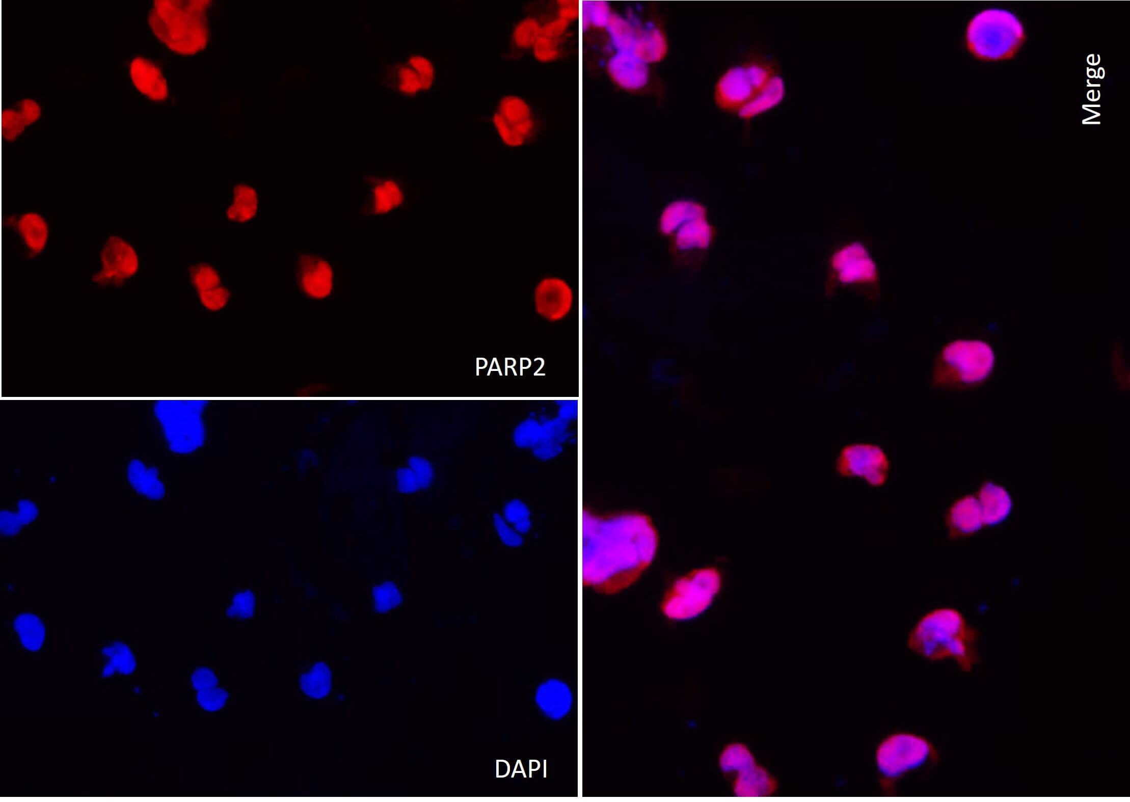 AbFlex<sup>®</sup> PARP2 antibody (rAb) tested by immunofluorescence.