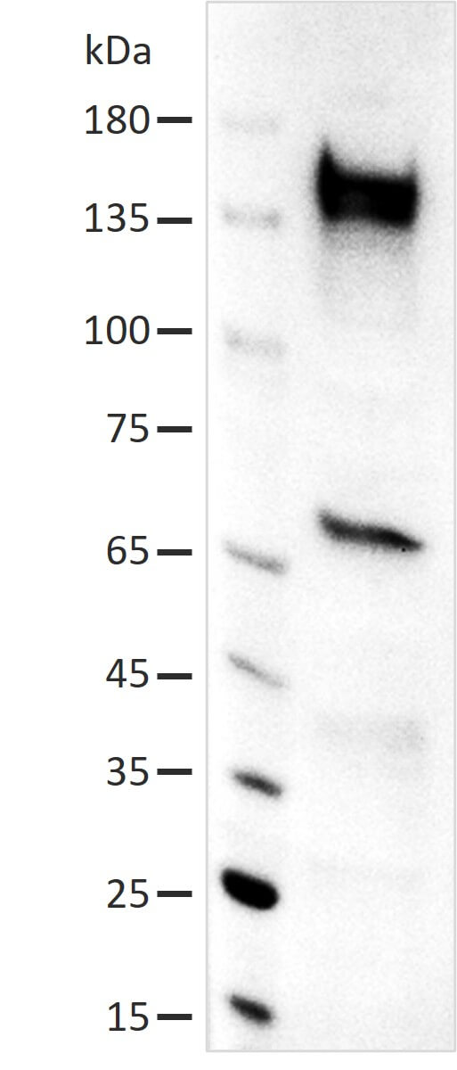 AbFlex<sup>®</sup> GLI1 antibody (rAb) tested by Western blot.