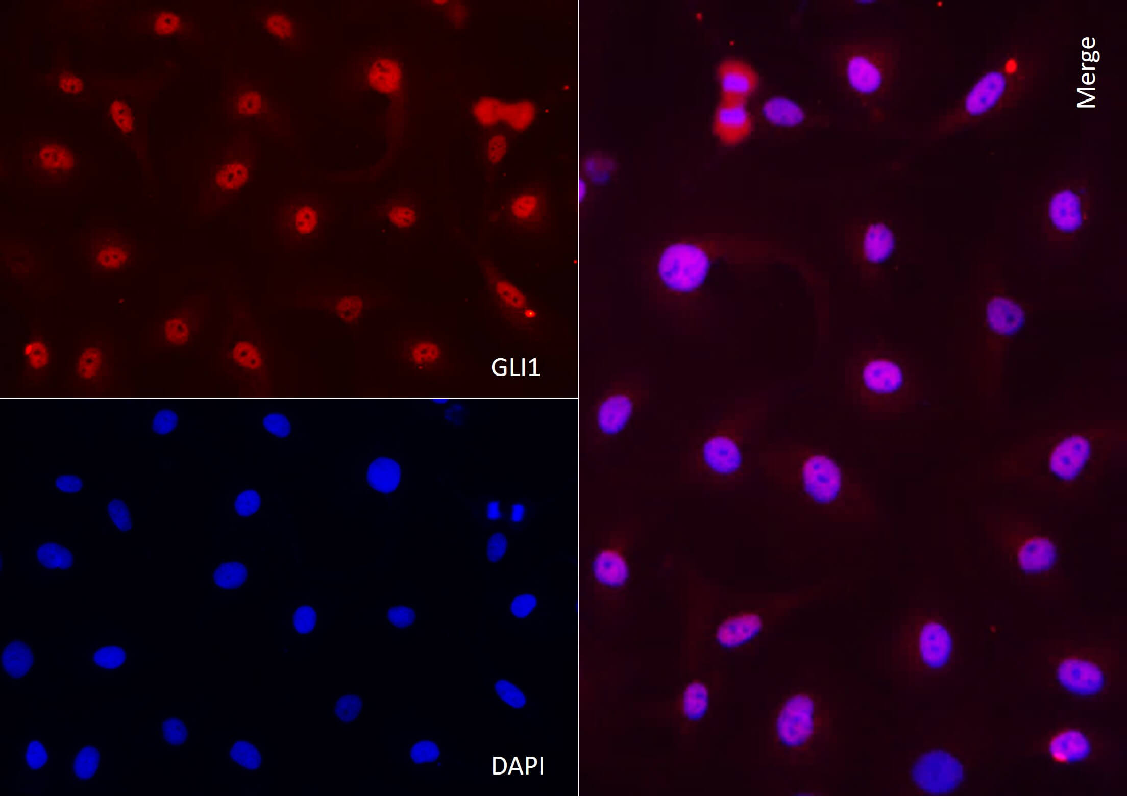 AbFlex<sup>®</sup> GLI1 antibody (rAb) tested by immunofluorescence.