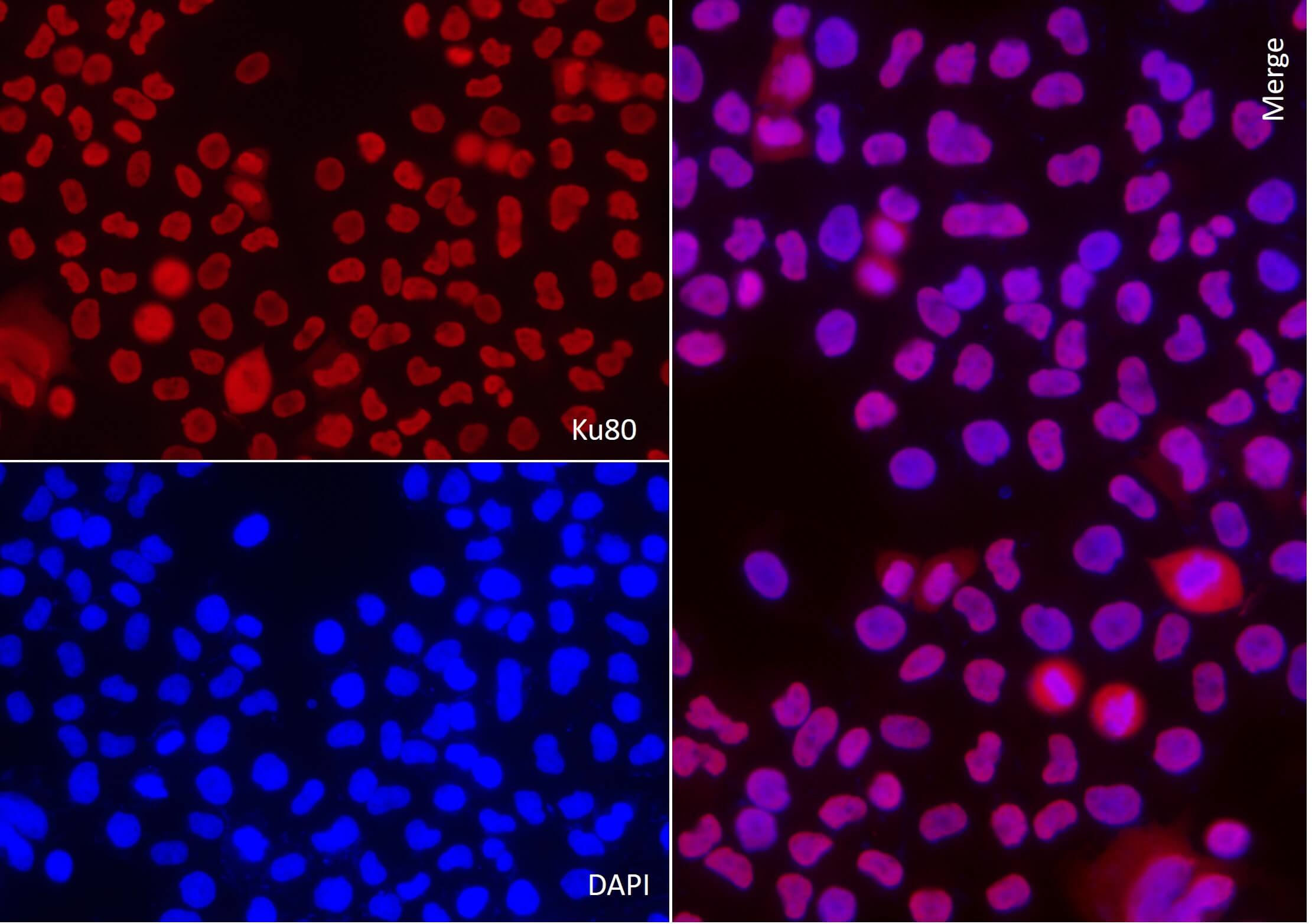 AbFlex<sup>®</sup> XRCC5 (Ku80) antibody (rAb) tested by immunofluorescence.