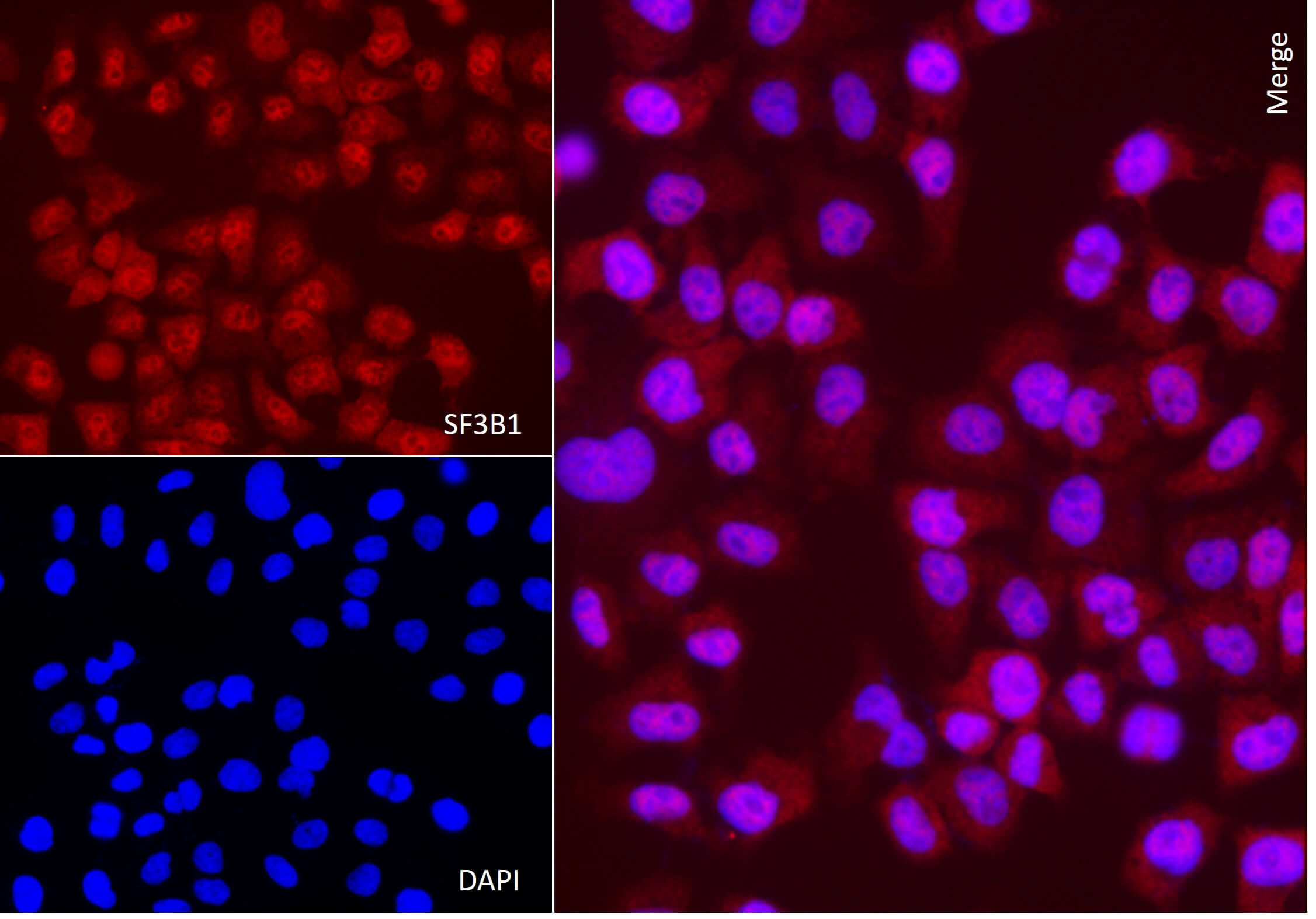 AbFlex<sup>®</sup> SF3B1 antibody (rAb) tested by immunofluorescence.