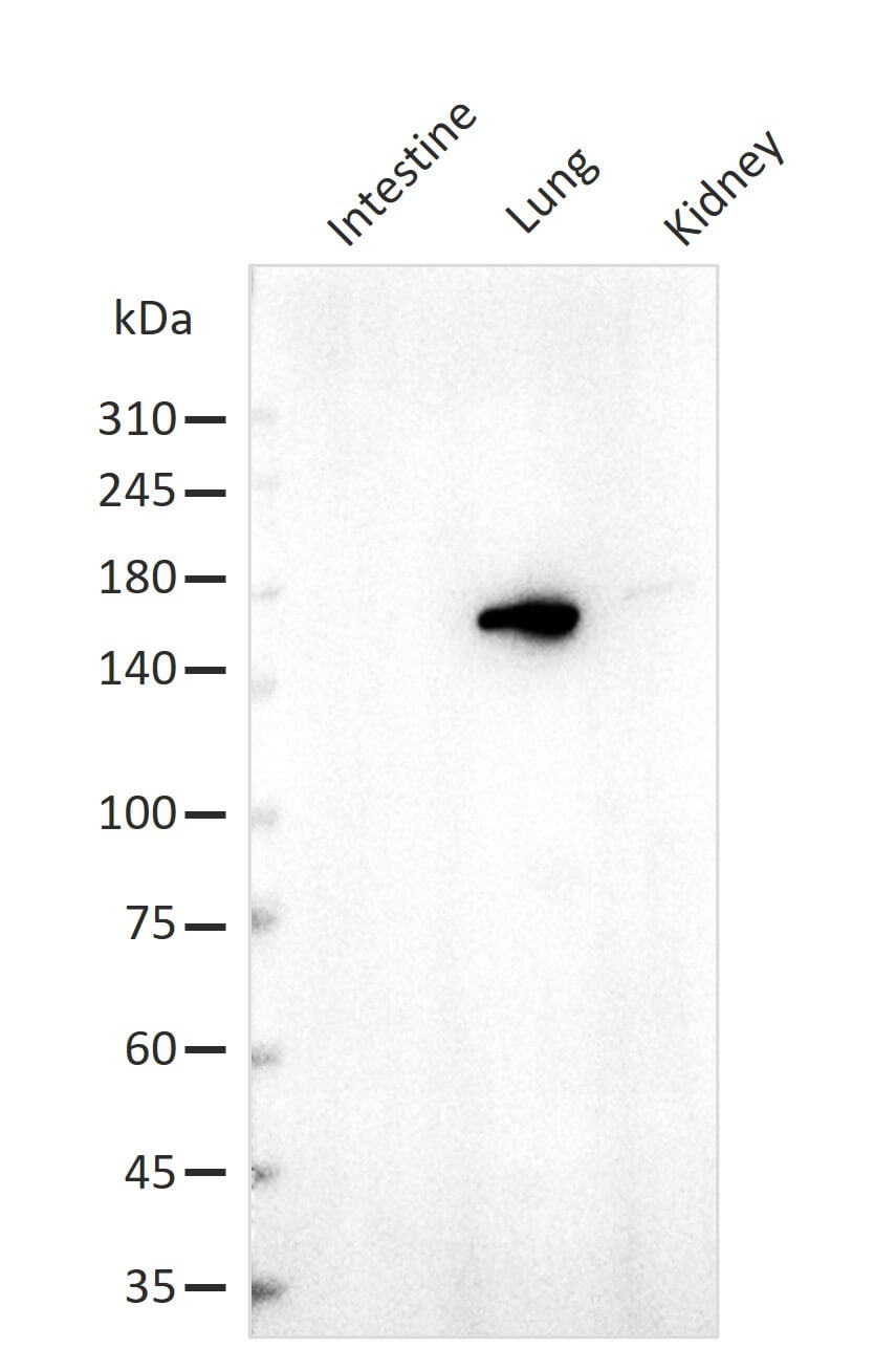 AbFlex<sup>&reg;</sup> SF3B1 antibody (rAb) tested by Western blot.