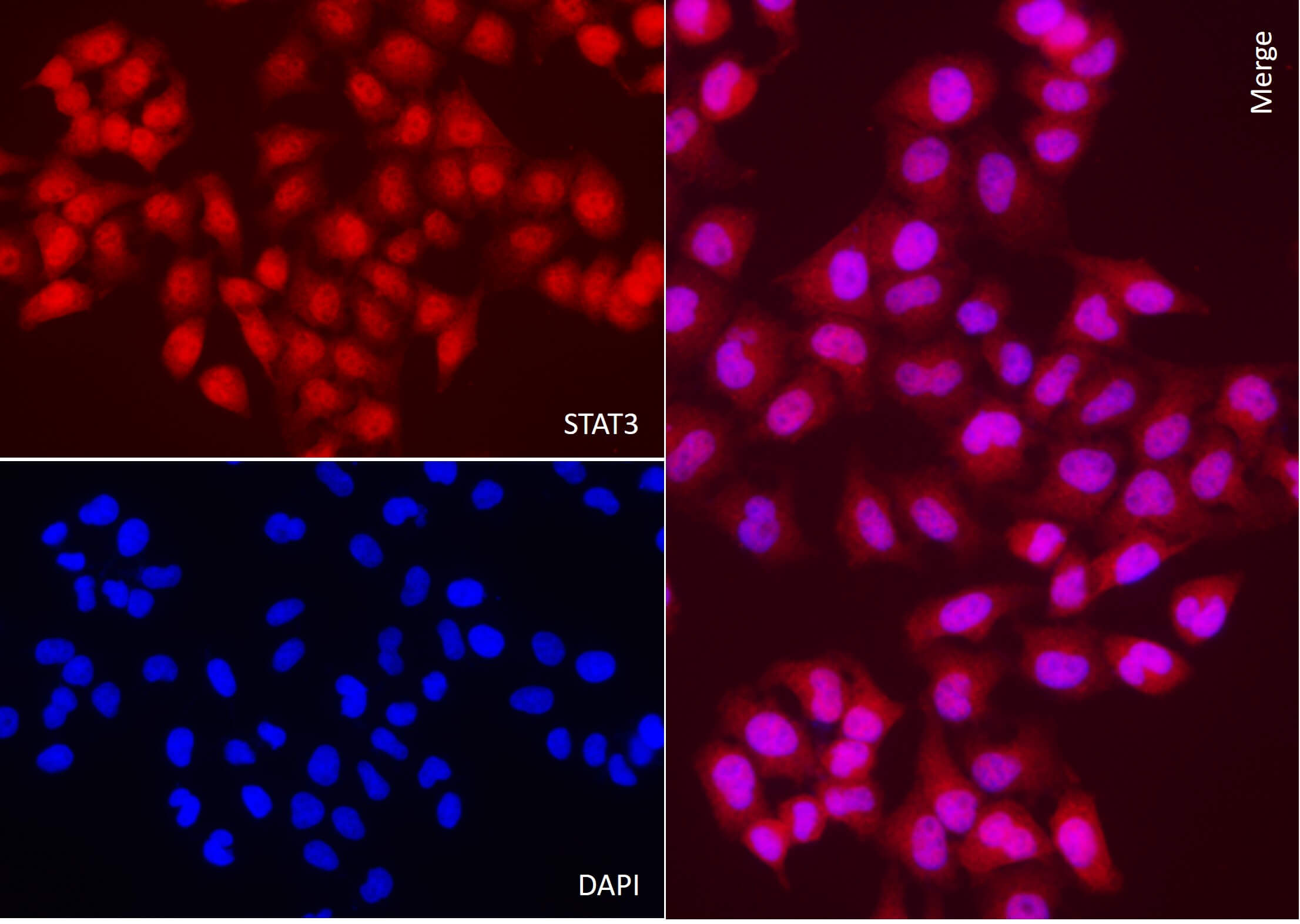 AbFlex<sup>&reg;</sup> STAT3 antibody (rAb) tested by immunofluorescence.