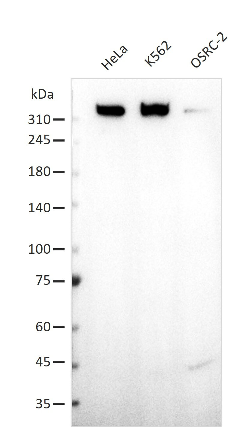 AbFlex<sup>®</sup> TP53BP1 antibody (rAb) tested by Western blot.