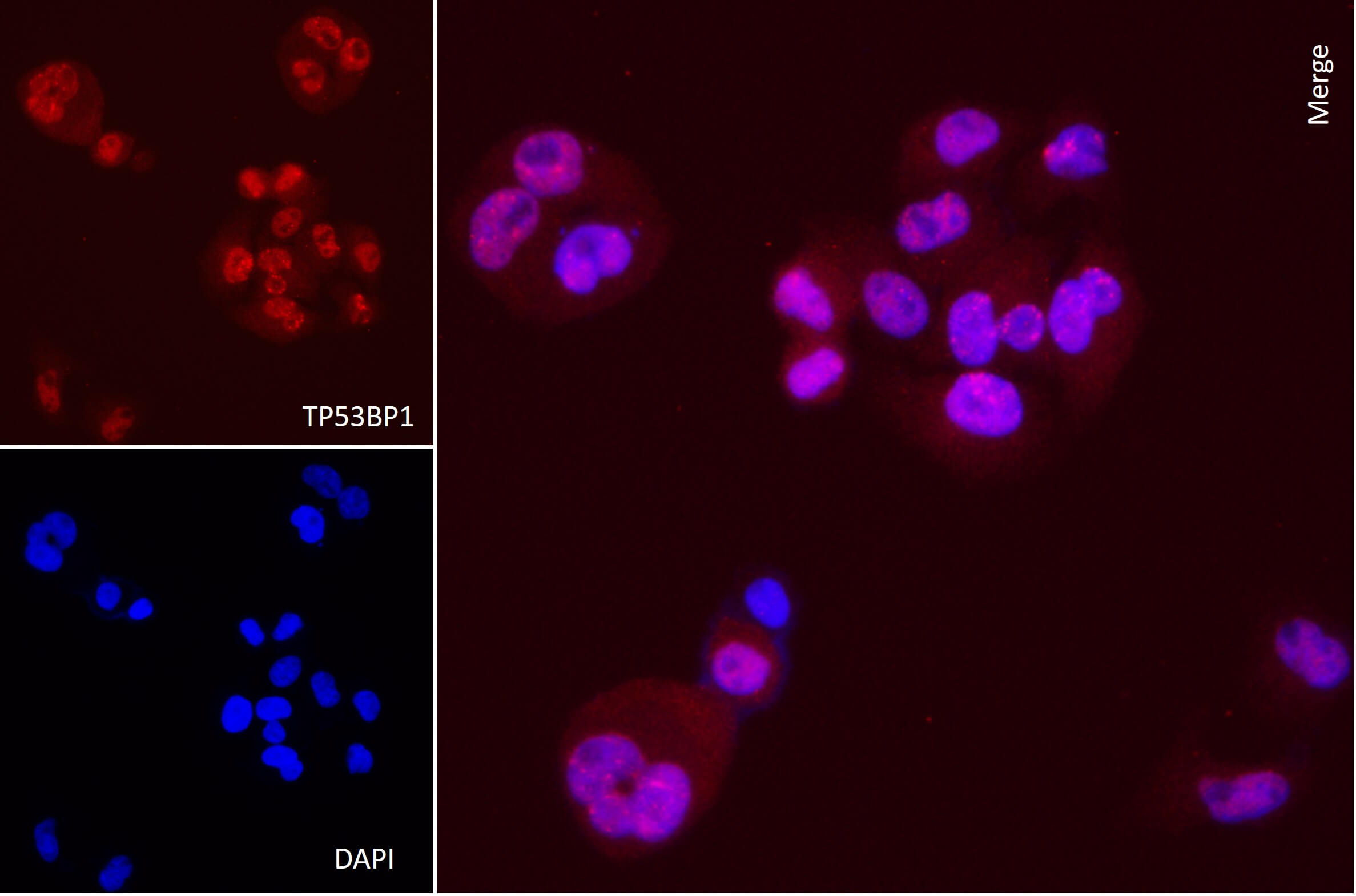AbFlex<sup>®</sup> TP53BP1 antibody (rAb) tested by immunofluorescence.