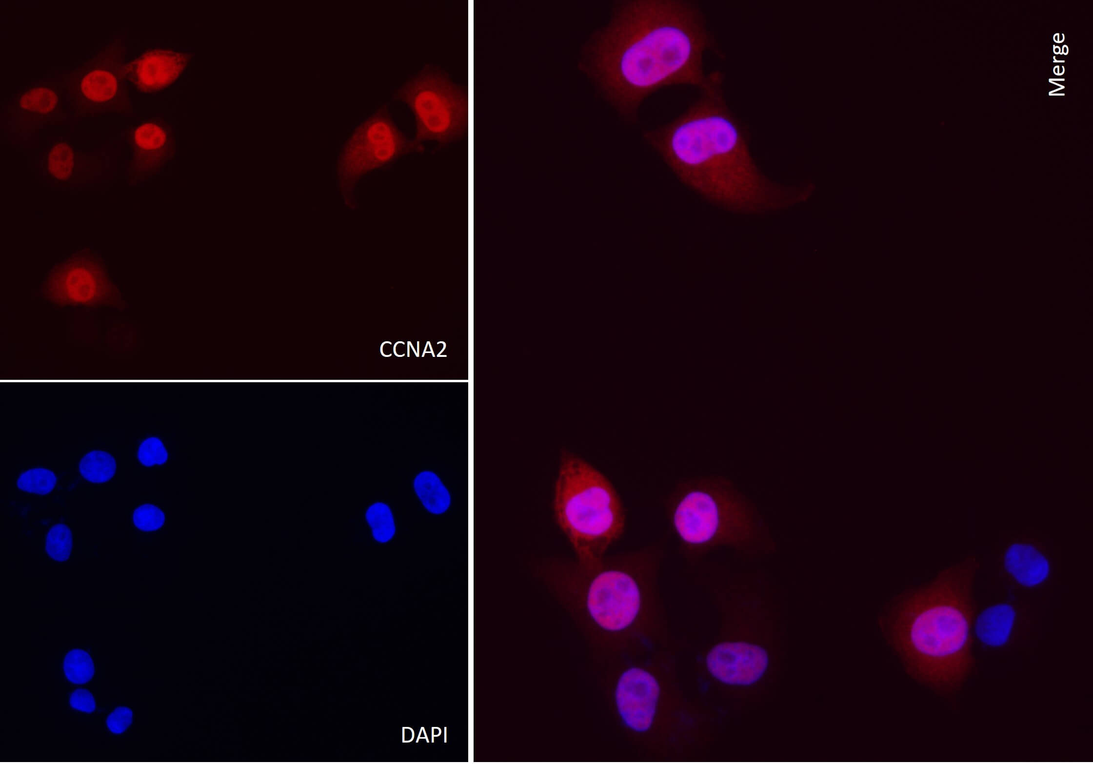 AbFlex<sup>&reg;</sup> CCNA2 (Cyclin A2) antibody (rAb) tested by immunofluorescence.
