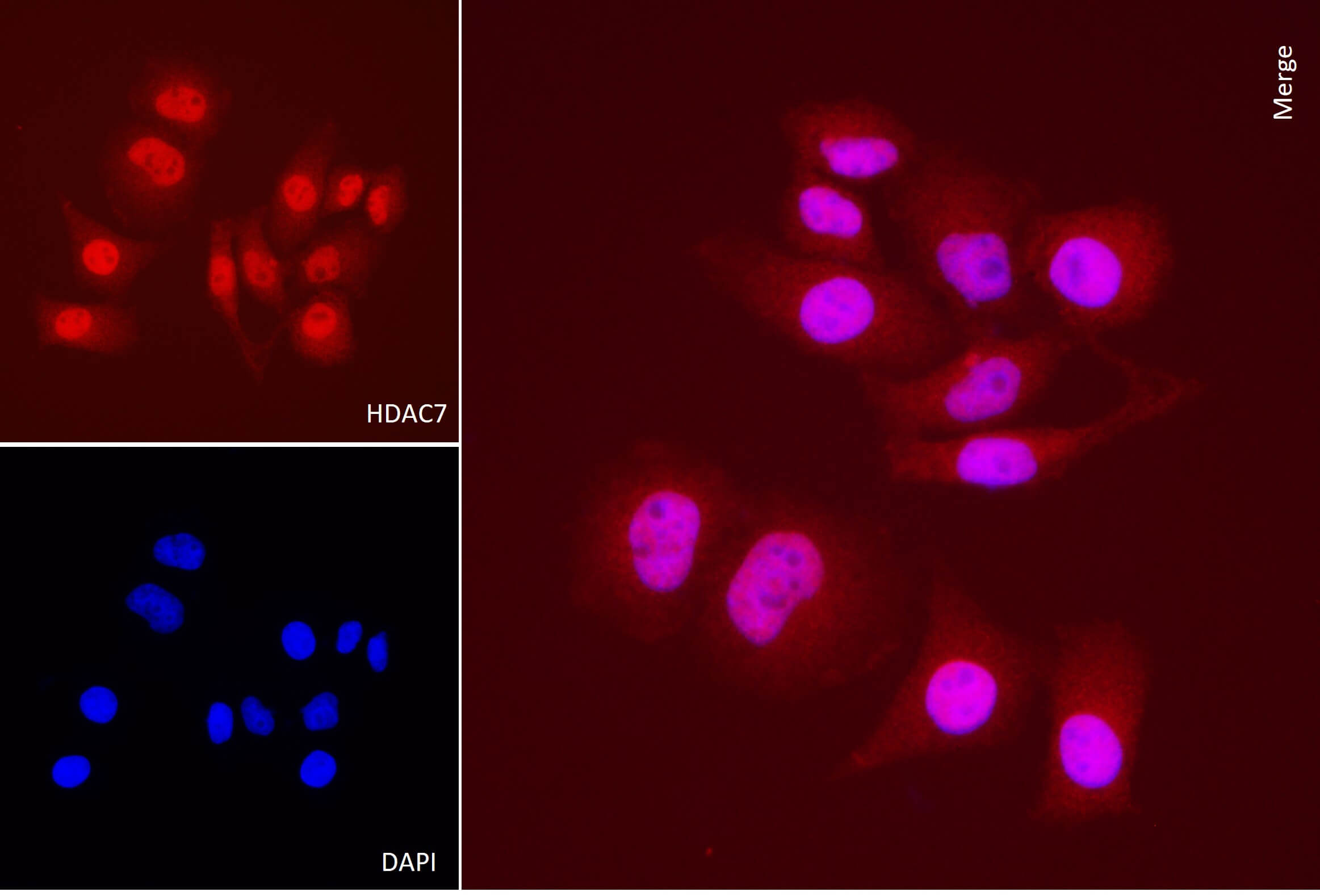 AbFlex<sup>®</sup> HDAC7 antibody (rAb) tested by immunofluorescence.