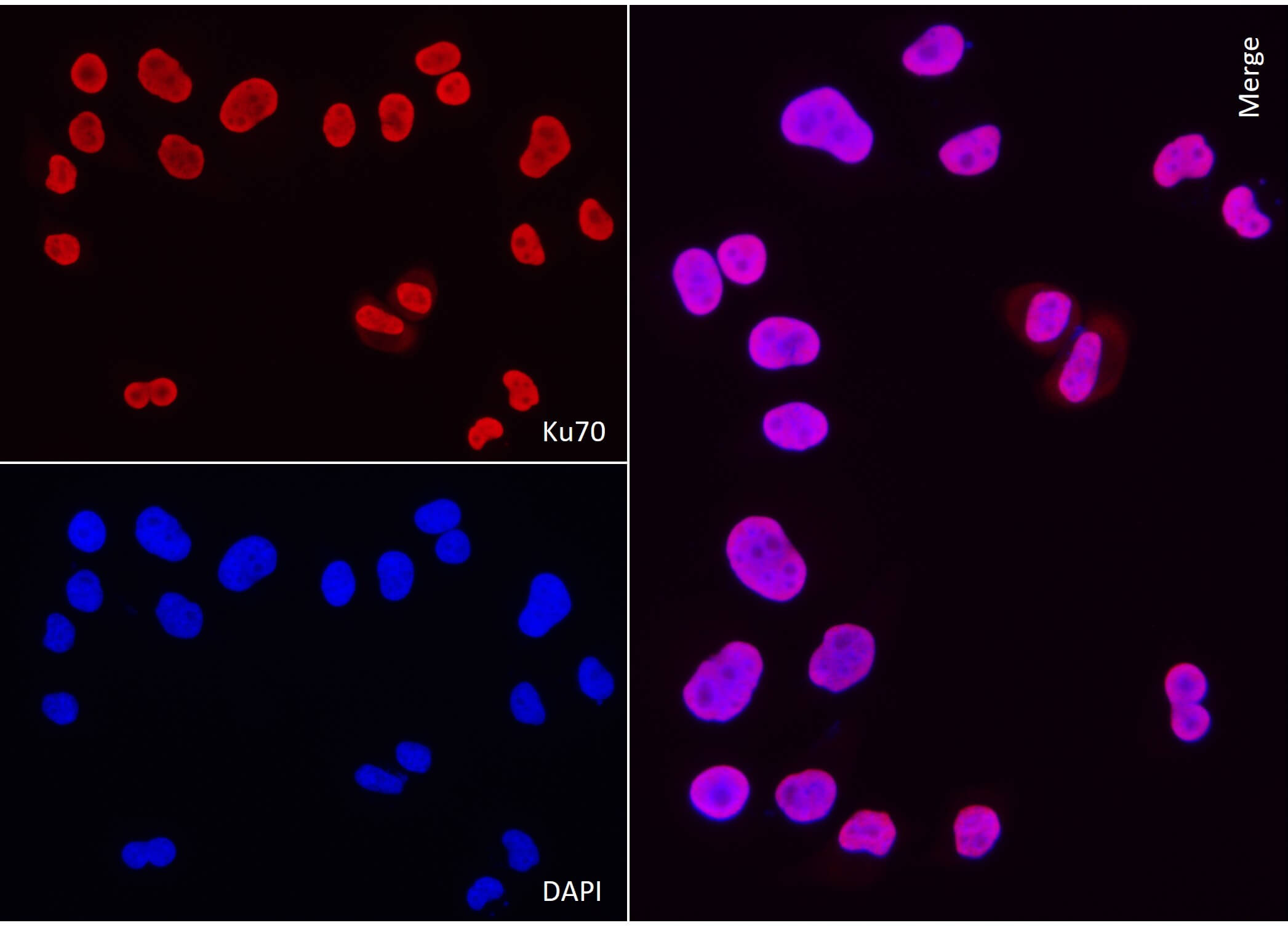AbFlex<sup>®</sup> XRCC6 (Ku70) antibody (rAb) tested by immunofluorescence.