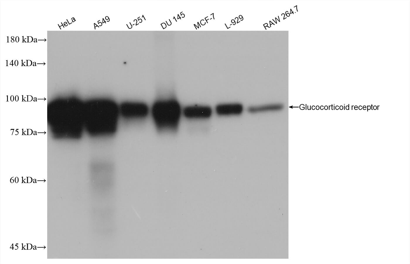 NR3C1 antibody (rAb), 100 µg tested by Western blot.
