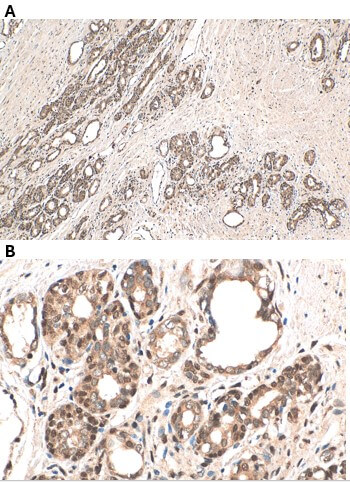 NR3C1 antibody (rAb), 100 µg tested by immunohistochemistry.