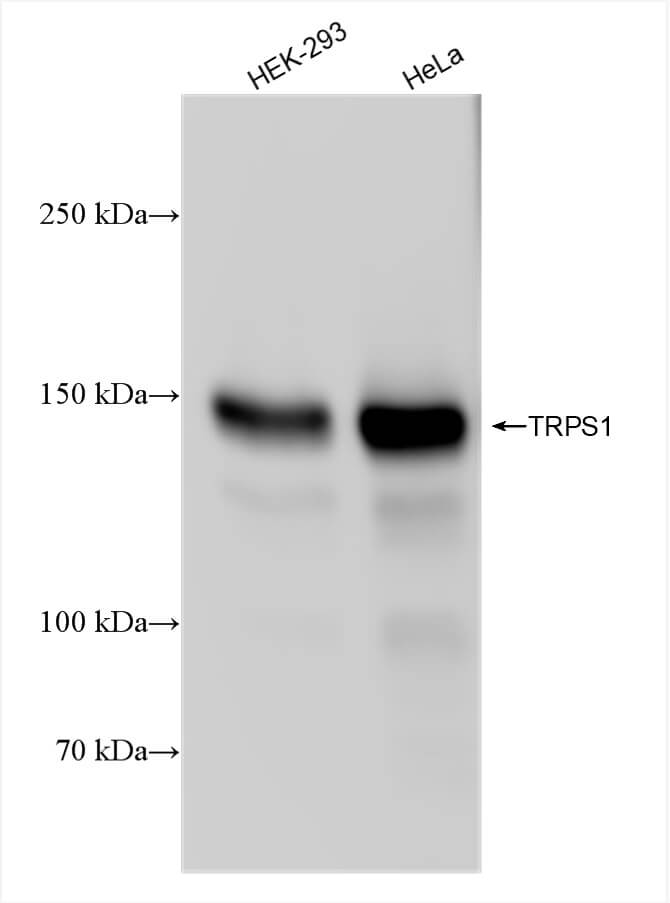 TRPS1 antibody (rAb), 100 µg tested by Western blot.
