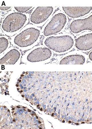 WT1 antibody (rAb), 100 µl tested by immunohistochemistry.