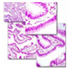 ChIP from Difficult Samples Webinar