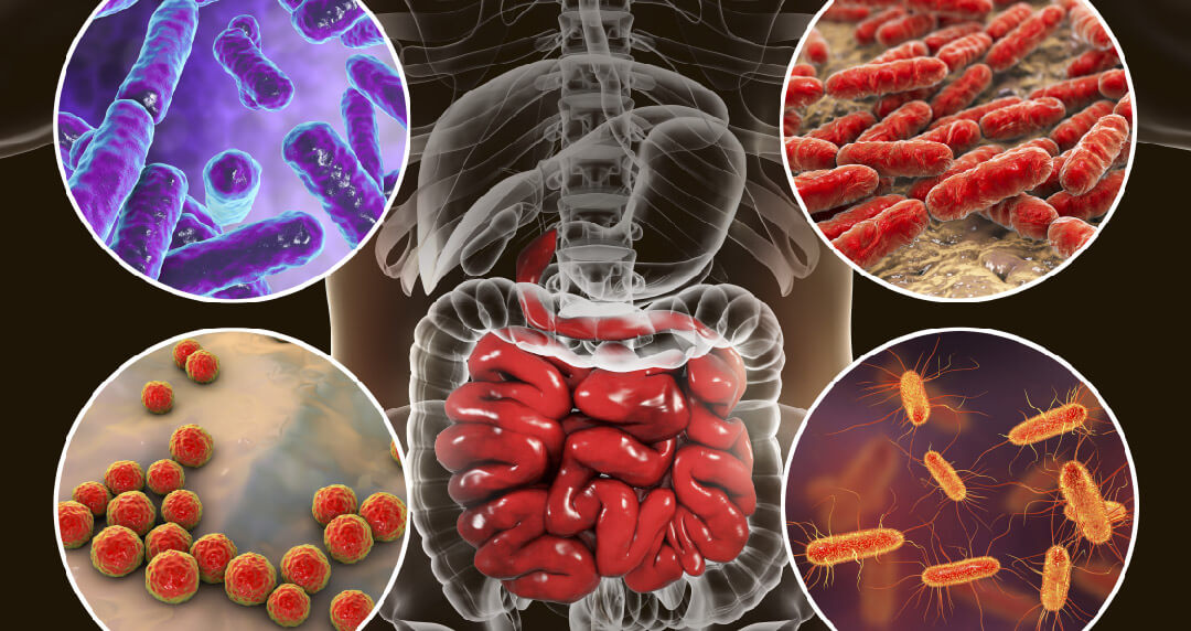 Oncohistones: Histone Mutations & their Oncogenic Effects