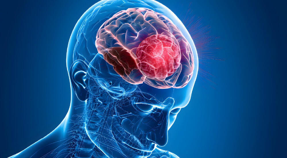 Brain