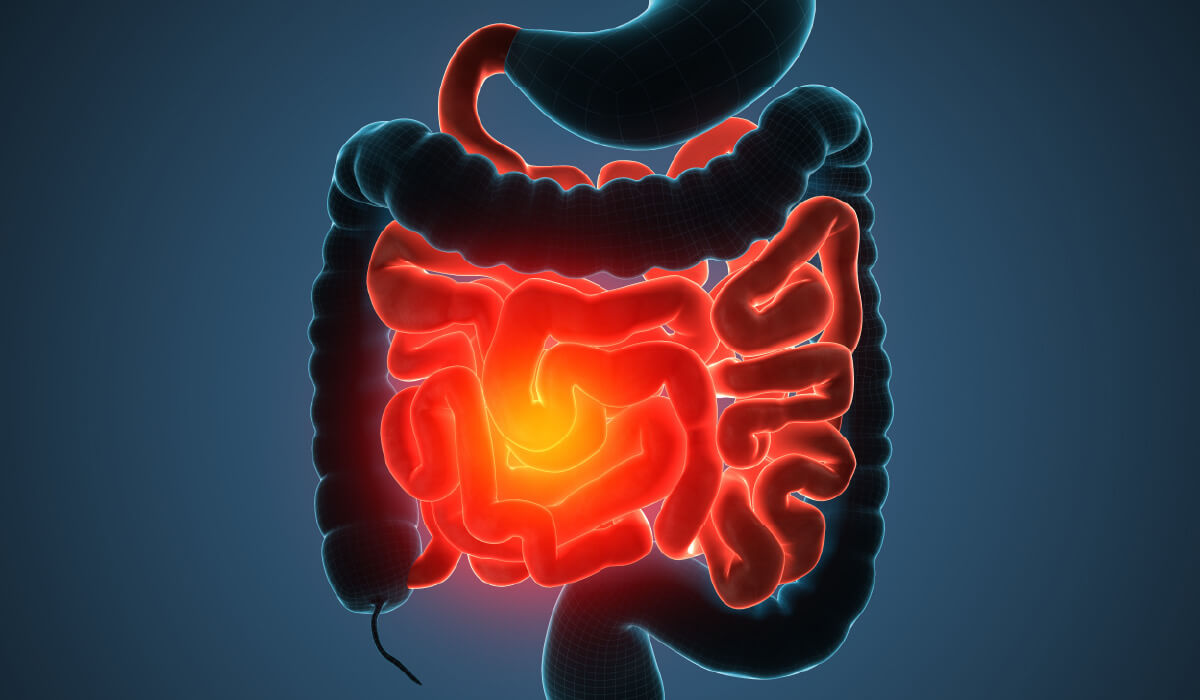 Intestines