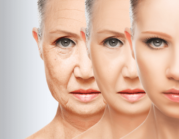 Reverse Epigenetic Aging