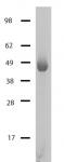 HDAC4 Coomassie gel.