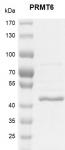 PRMT6 Coomassie gel