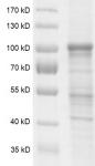 DNMT3B protein Coomassie gel