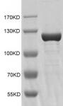 Recombinant KDM1B / LSD2 Coomassie gel