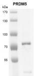 PRDM5 protein Coomassie gel