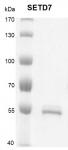 SETD7 protein Coomassie gel