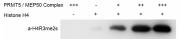 PRMT / MEP50 complex, Activity Assay